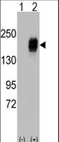 EGFR Antibody - Western blot of EGFR (arrow) using rabbit polyclonal EGFR Antibody. 293 cell lysates (2 ug/lane) either nontransfected (Lane 1) or transiently transfected with the EGFR gene (Lane 2) (Origene Technologies).