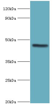 EGLN1 / PHD2 Antibody - Western blot. All lanes: Egl nine homolog 1 antibody at 12 ug/ml+rat brain tissue. Secondary antibody: Goat polyclonal to rabbit at 1:10000 dilution. Predicted band size: 46 kDa. Observed band size: 46 kDa Immunohistochemistry.