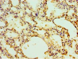 EGLN1 / PHD2 Antibody - Immunohistochemistry of paraffin-embedded human lung using antibody 1:100 dilution.