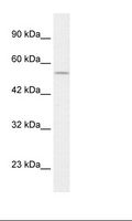EGLN1 / PHD2 Antibody - HepG2 Cell Lysate.  This image was taken for the unconjugated form of this product. Other forms have not been tested.