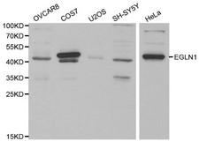 EGLN1 / PHD2 Antibody - Western blot of EGLN1 pAb in extracts from OVCAR8, COS7, U2OS, SH-SY5Y and Hela cells.