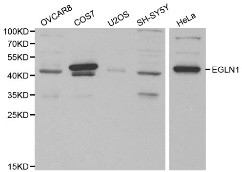 EGLN1 / PHD2 Antibody - Western blot of EGLN1 pAb in extracts from OVCAR8, COS7, U2OS, SH-SY5Y and Hela cells.