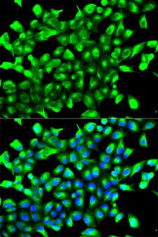 EGLN1 / PHD2 Antibody - Immunofluorescence analysis of MCF-7 cells.