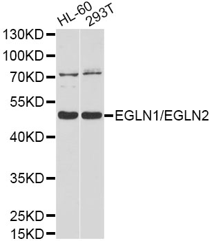 EGLN1 / PHD2 Antibody - Western blot analysis of extracts of various cell lines, using EGLN1/EGLN2 antibody at 1:1000 dilution. The secondary antibody used was an HRP Goat Anti-Rabbit IgG (H+L) at 1:10000 dilution. Lysates were loaded 25ug per lane and 3% nonfat dry milk in TBST was used for blocking. An ECL Kit was used for detection and the exposure time was 90s.