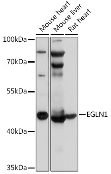 EGLN1 / PHD2 Antibody - Western blot analysis of extracts of various cell lines, using EGLN1 antibody at 1:3000 dilution. The secondary antibody used was an HRP Goat Anti-Rabbit IgG (H+L) at 1:10000 dilution. Lysates were loaded 25ug per lane and 3% nonfat dry milk in TBST was used for blocking. An ECL Kit was used for detection and the exposure time was 30s.