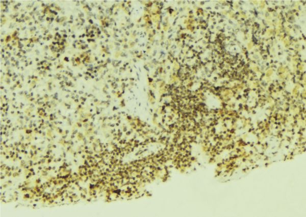 EGLN1 / PHD2 Antibody - 1:100 staining mouse pancreas tissue by IHC-P. The sample was formaldehyde fixed and a heat mediated antigen retrieval step in citrate buffer was performed. The sample was then blocked and incubated with the antibody for 1.5 hours at 22°C. An HRP conjugated goat anti-rabbit antibody was used as the secondary.