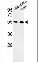 EGLN2 / PHD1 Antibody - Western blot of EGLN2 Antibody in MDA-MB231, HeLa cell line lysates (35 ug/lane). EGLN2 (arrow) was detected using the purified antibody.