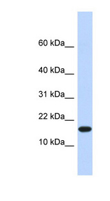 EGLN2 / PHD1 Antibody - EGLN2 / PHD1 antibody Western blot of Fetal Heart lysate. This image was taken for the unconjugated form of this product. Other forms have not been tested.