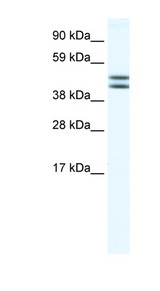 EGLN2 / PHD1 Antibody - EGLN2 / PHD1 antibody Western blot of Placenta lysate. This image was taken for the unconjugated form of this product. Other forms have not been tested.
