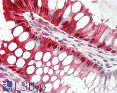 EGLN2 / PHD1 Antibody - Human Colon: Formalin-Fixed, Paraffin-Embedded (FFPE).  This image was taken for the unconjugated form of this product. Other forms have not been tested.