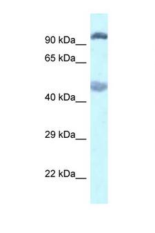 EGLN2 / PHD1 Antibody - Western blot of Rat Muscle lysate. EGLN2 / PHD1 Antibody concentration 1 ug/ml.  This image was taken for the unconjugated form of this product. Other forms have not been tested.