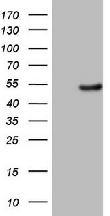 EGLN2 / PHD1 Antibody - HEK293T cells were transfected with the pCMV6-ENTRY control. (Left lane) or pCMV6-ENTRY EGLN2. (Right lane) cDNA for 48 hrs and lysed. Equivalent amounts of cell lysates. (5 ug per lane) were separated by SDS-PAGE and immunoblotted with anti-EGLN2. (1:2000)