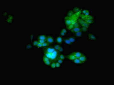 EGLN2 / PHD1 Antibody - Immunofluorescent analysis of PC-3 cells using EGLN2 Antibody at dilution of 1:100 and Alexa Fluor 488-congugated AffiniPure Goat Anti-Rabbit IgG(H+L)