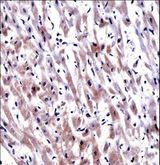 EGLN3 / PHD3 Antibody - EGLN3 Antibody immunohistochemistry of formalin-fixed and paraffin-embedded human heart tissue followed by peroxidase-conjugated secondary antibody and DAB staining.