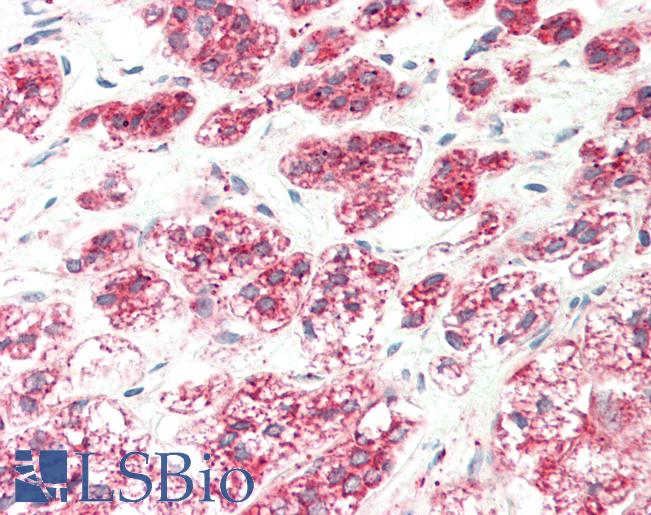 EGLN3 / PHD3 Antibody - Human Adrenal: Formalin-Fixed, Paraffin-Embedded (FFPE).  This image was taken for the unconjugated form of this product. Other forms have not been tested.