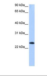 EGLN3 / PHD3 Antibody - Human fetal brain cell lysate. Antibody concentration: 1.0 ug/ml. Gel concentration: 12%.  This image was taken for the unconjugated form of this product. Other forms have not been tested.