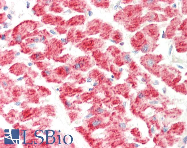 EGLN3 / PHD3 Antibody - Human Heart: Formalin-Fixed, Paraffin-Embedded (FFPE).  This image was taken for the unconjugated form of this product. Other forms have not been tested.