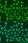 EGLN3 / PHD3 Antibody - Immunofluorescence analysis of U2OS cells using EGLN3 Polyclonal Antibody at dilution of 1:100.Blue: DAPI for nuclear staining.