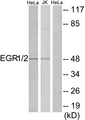EGR1 + EGR2 Antibody - Western blot analysis of lysates from HeLa and Jurkat cells, using EGR1/2 Antibody. The lane on the right is blocked with the synthesized peptide.