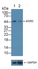 EGR2 Antibody - Knockout Varification: Lane 1: Wild-type HepG2 cell lysate; Lane 2: EGR2 knockout HepG2 cell lysate; Predicted MW: 50,45kd Observed MW: 45kd Primary Ab: 1µg/ml Rabbit Anti-Human EGR2 Antibody Second Ab: 0.2µg/mL HRP-Linked Caprine Anti-Rabbit IgG Polyclonal Antibody