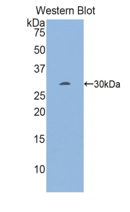 EGR2 Antibody - Western blot of recombinant EGR2.  This image was taken for the unconjugated form of this product. Other forms have not been tested.