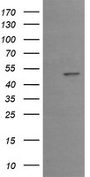 EGR2 Antibody - HEK293T cells were transfected with the pCMV6-ENTRY control (Left lane) or pCMV6-ENTRY EGR2 (Right lane) cDNA for 48 hrs and lysed. Equivalent amounts of cell lysates (5 ug per lane) were separated by SDS-PAGE and immunoblotted with anti-EGR2.