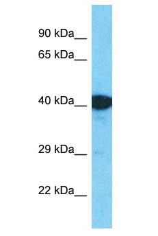 EGR2 Antibody - EGR2 antibody Western Blot of Fetal Kidney. Antibody dilution: 1 ug/ml.  This image was taken for the unconjugated form of this product. Other forms have not been tested.