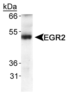 EGR2 Antibody - Detection of ERG2 in human fetal lung extracts using antibody.  This image was taken for the unconjugated form of this product. Other forms have not been tested.
