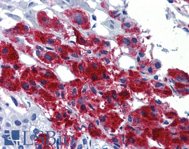 EGR2 Antibody - Anti-EGR2 antibody IHC of human adrenal. Immunohistochemistry of formalin-fixed, paraffin-embedded tissue after heat-induced antigen retrieval. Antibody concentration 5 ug/ml.  This image was taken for the unconjugated form of this product. Other forms have not been tested.