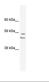 EGR2 Antibody - Fetal Lung Lysate.  This image was taken for the unconjugated form of this product. Other forms have not been tested.