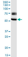 EGR2 Antibody - EGR2 monoclonal antibody (M03), clone 1G5. Western Blot analysis of EGR2 expression in rat brain.