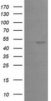 EGR2 Antibody - HEK293T cells were transfected with the pCMV6-ENTRY control (Left lane) or pCMV6-ENTRY EGR2 (Right lane) cDNA for 48 hrs and lysed. Equivalent amounts of cell lysates (5 ug per lane) were separated by SDS-PAGE and immunoblotted with anti-EGR2.