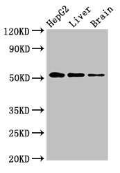 EGR2 Antibody - Western Blot Positive WB detected in:HepG2 whole cell lysate,Rat liver tissue,Rat brain tissue All Lanes:EGR2 antibody at 3.4µg/ml Secondary Goat polyclonal to rabbit IgG at 1/50000 dilution Predicted band size: 51,45 KDa Observed band size: 51 KDa