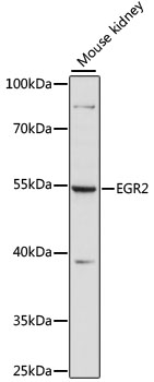 EGR2 Antibody - Western blot analysis of extracts of mouse kidney, using EGR2 antibody at 1:1000 dilution. The secondary antibody used was an HRP Goat Anti-Rabbit IgG (H+L) at 1:10000 dilution. Lysates were loaded 25ug per lane and 3% nonfat dry milk in TBST was used for blocking. An ECL Kit was used for detection and the exposure time was 60s.