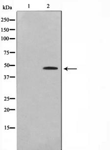 EGR2 Antibody - Western blot analysis on HeLa cell lysates using EGR2 antibody. The lane on the left is treated with the antigen-specific peptide.