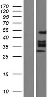 EGR2 Protein - Western validation with an anti-DDK antibody * L: Control HEK293 lysate R: Over-expression lysate