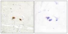 EGR3 Antibody - Immunohistochemistry analysis of paraffin-embedded human brain tissue, using EGR3 Antibody. The picture on the right is blocked with the synthesized peptide.