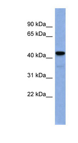 EGR3 Antibody - EGR3 antibody Western blot of Fetal Spleen lysate. This image was taken for the unconjugated form of this product. Other forms have not been tested.