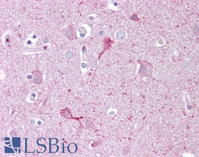 EGR3 Antibody - Anti-EGR3 antibody IHC of human brain, cortex. Immunohistochemistry of formalin-fixed, paraffin-embedded tissue after heat-induced antigen retrieval. Antibody concentration 5 ug/ml.  This image was taken for the unconjugated form of this product. Other forms have not been tested.