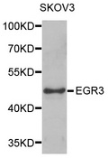 EGR3 Antibody - Western blot analysis of extracts of SKOV3 cells.