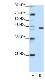 EGR4 / EGR-4 Antibody - EGR4 antibody Western blot of Jurkat lysate. This image was taken for the unconjugated form of this product. Other forms have not been tested.