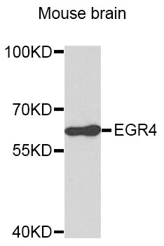 EGR4 / EGR-4 Antibody - Western blot analysis of extracts of Mouse brain cells.