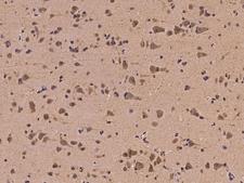 EGR4 / EGR-4 Antibody - Immunochemical staining of human EGR4 in human brain with rabbit polyclonal antibody at 1:100 dilution, formalin-fixed paraffin embedded sections.