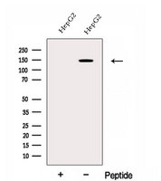 EHBP1 Antibody - Western blot analysis of extracts of HepG2 cells using EHBP1 antibody. The lane on the left was treated with blocking peptide.