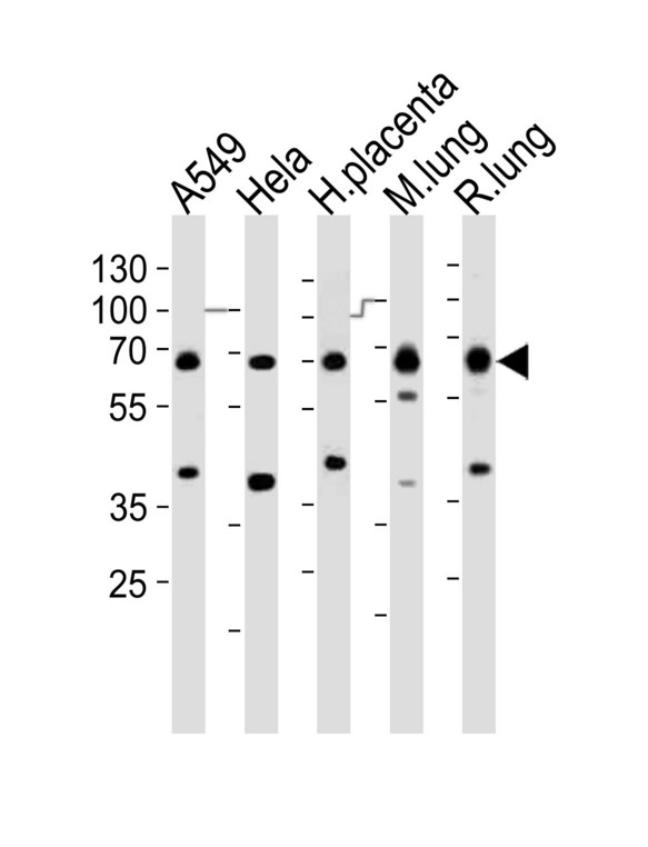EHD2 Antibody - Western blot of lysates from A549, HeLa cell line, human placenta, mouse lung, rat lung tissue (from left to right), using EHD2 antibody diluted at 1:1000 at each lane. A goat anti-rabbit IgG H&L (HRP) at 1:10000 dilution was used as the secondary antibody. Lysates at 20 ug per lane.