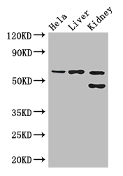EHD2 Antibody - Positive WB detected in:Hela whole cell lysate,Mouse liver tissue,Mouse kidney tissue;All lanes: EHD2 antibody at 3ug/ml;Secondary;Goat polyclonal to rabbit IgG at 1/50000 dilution;Predicted band size: 62,47 kDa;Observed band size: 62,47 kDa;