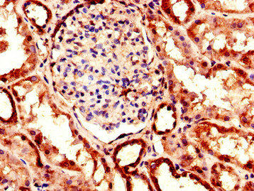 EHD2 Antibody - Immunohistochemistry of paraffin-embedded human kidney tissue using EHD2 Antibody at dilution of 1:100