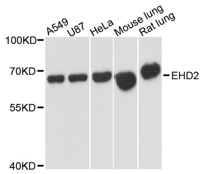 EHD2 Antibody - Western blot analysis of extracts of various cell lines, using EHD2 antibody at 1:3000 dilution. The secondary antibody used was an HRP Goat Anti-Rabbit IgG (H+L) at 1:10000 dilution. Lysates were loaded 25ug per lane and 3% nonfat dry milk in TBST was used for blocking. An ECL Kit was used for detection and the exposure time was 1s.