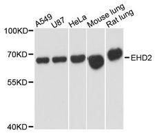 EHD2 Antibody - Western blot analysis of extracts of various cell lines, using EHD2 antibody at 1:3000 dilution. The secondary antibody used was an HRP Goat Anti-Rabbit IgG (H+L) at 1:10000 dilution. Lysates were loaded 25ug per lane and 3% nonfat dry milk in TBST was used for blocking. An ECL Kit was used for detection and the exposure time was 1s.