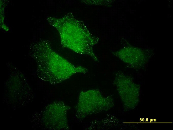 EHD3 Antibody - Immunofluorescence of monoclonal antibody to EHD3 on HeLa cell. [antibody concentration 25 ug/ml]